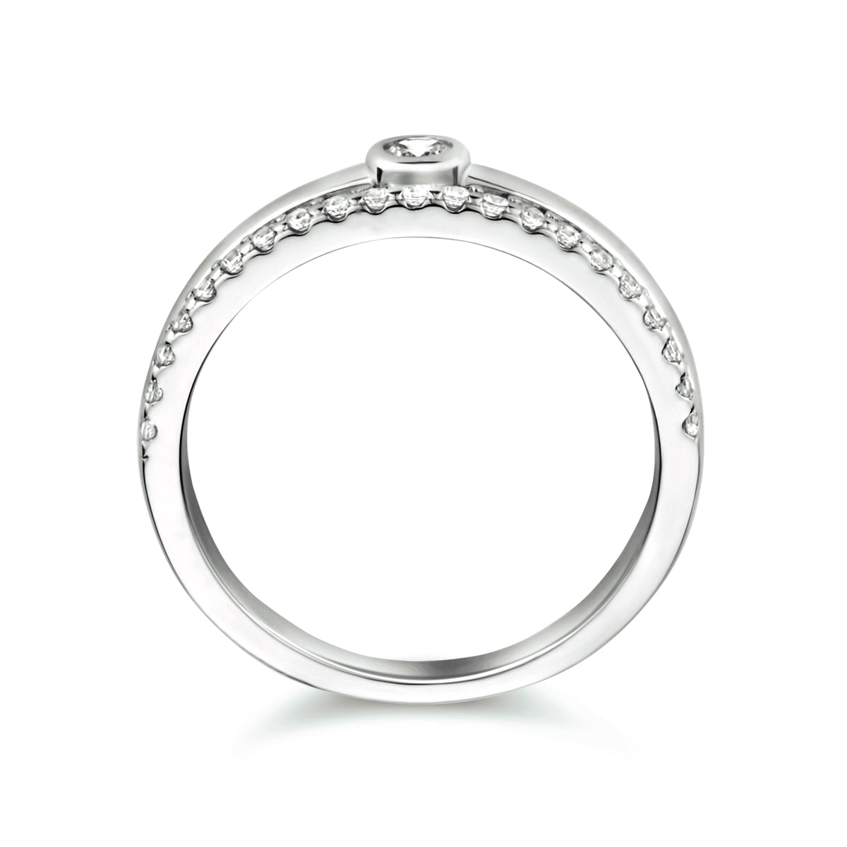 Ring zirkonia